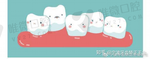 固定义齿的修复*度是指（全口义齿中立区排牙的优点是）(图1)